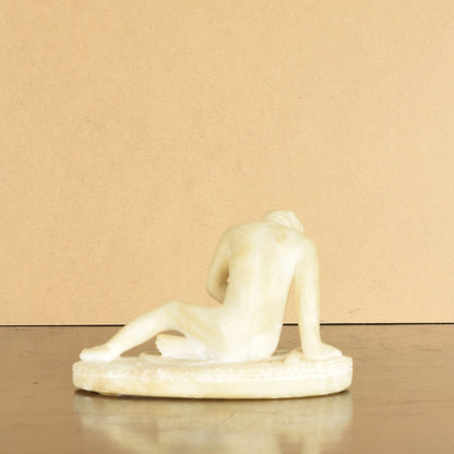 Dying Gaul